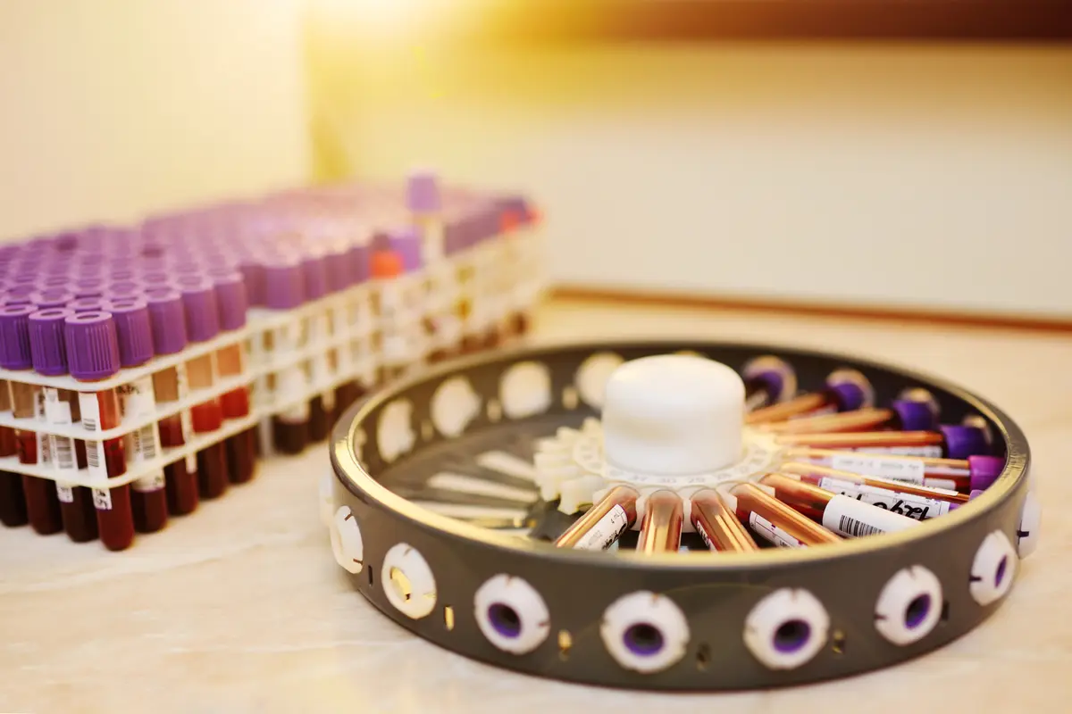Blood samples arranged in a centrifuge