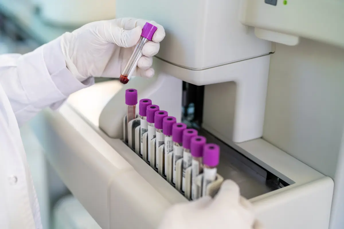 Blood tubes loaded into a lab analyzer