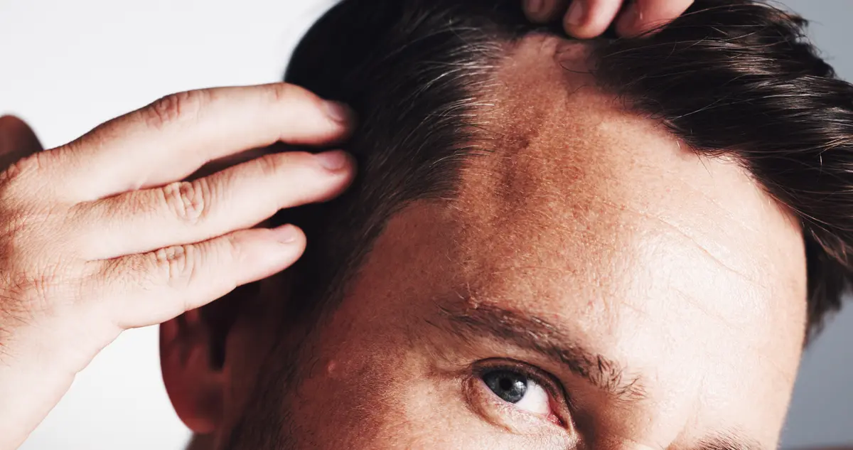 Close view of a man's hairline