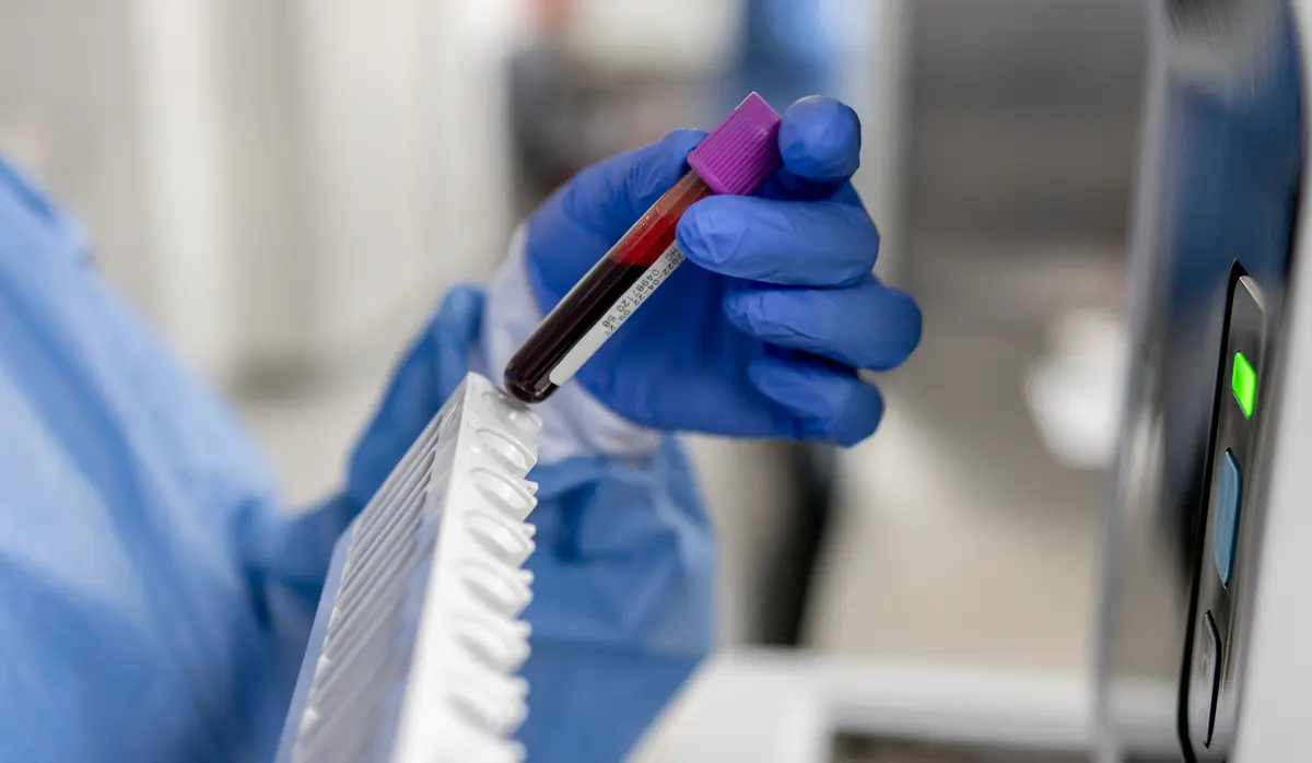 Gloved hand holding a blood sample tube