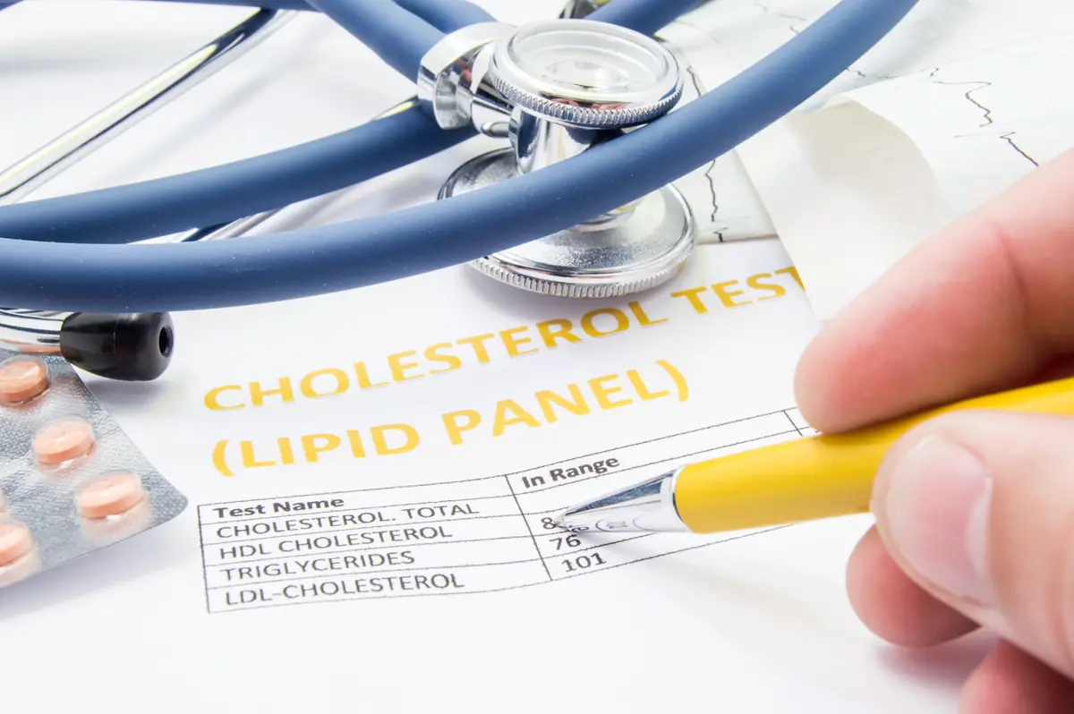 Lipid panel lab report with a stethoscope