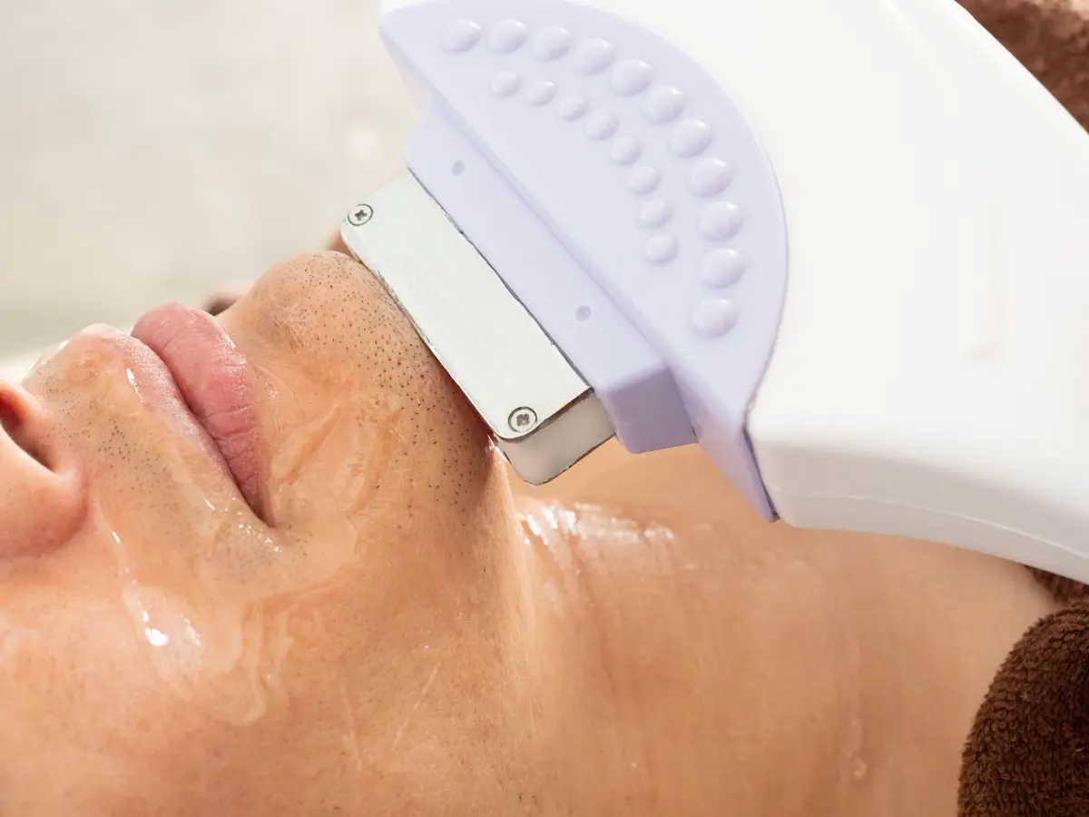 Man having a laser treatment along his jaw