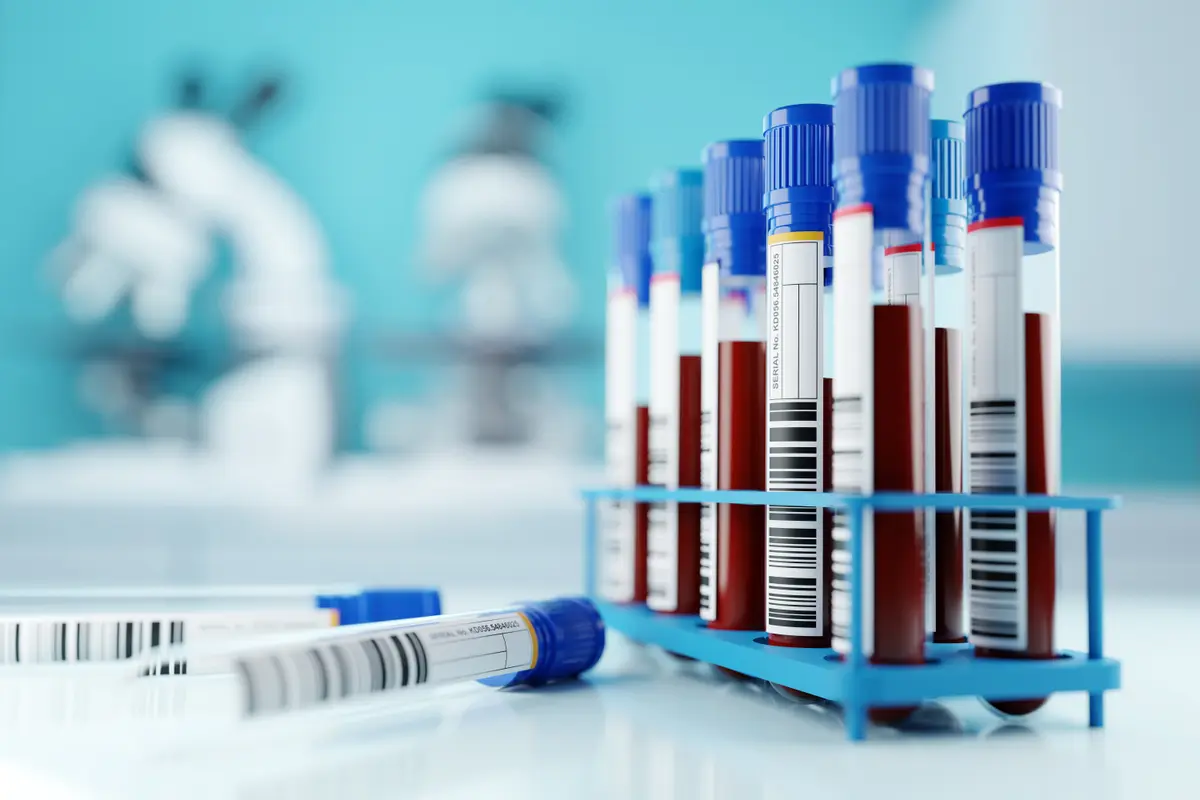 Rack of blood sample tubes in a lab