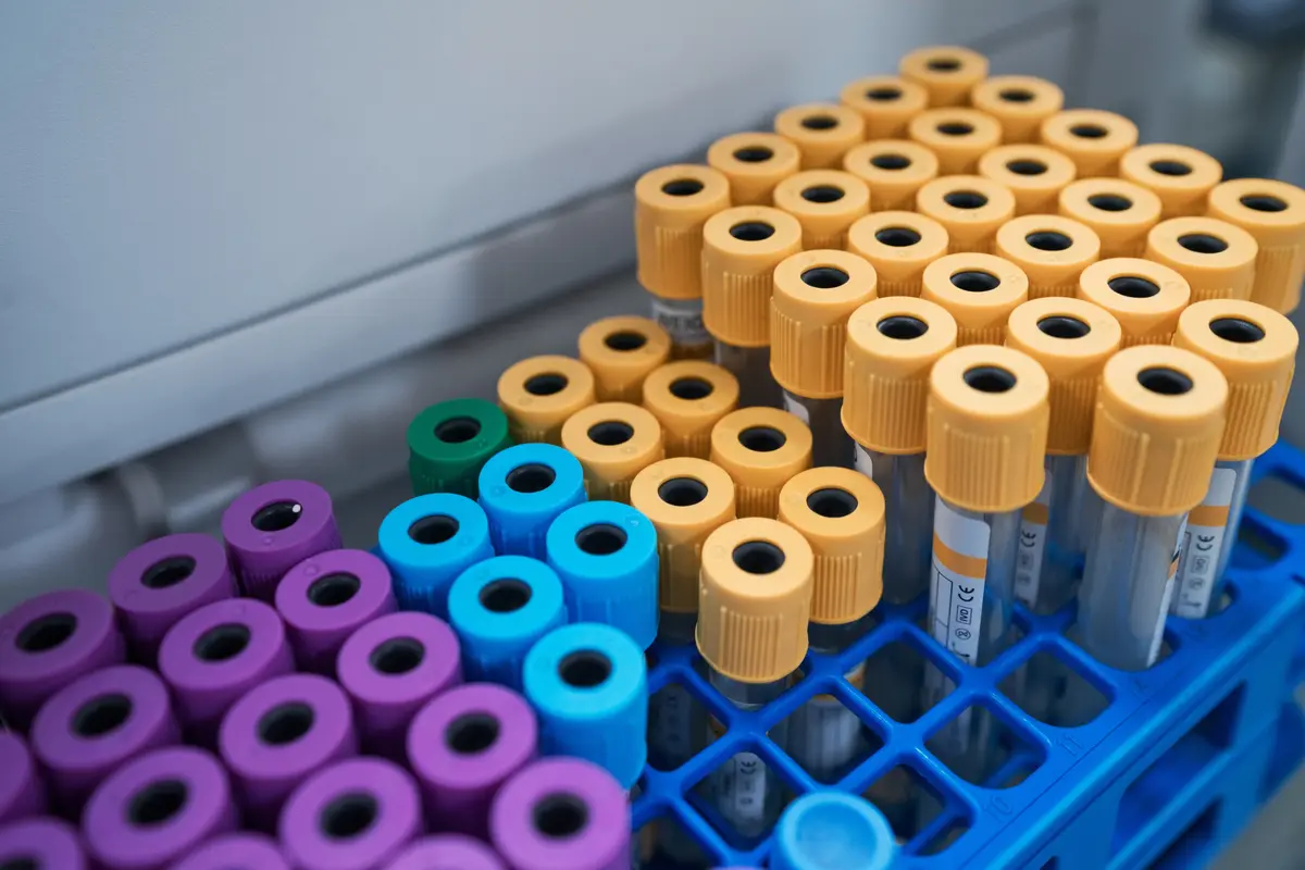 Rows of capped blood collection tubes